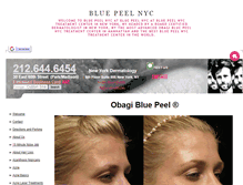 Tablet Screenshot of bluepeelnyc.org